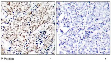 Anti-Chk1 (phospho Ser345) antibody used in IHC (Paraffin sections) (IHC-P). GTX79111