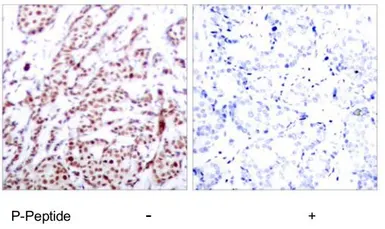 Anti-ATF2 (phospho Thr73) antibody used in IHC (Paraffin sections) (IHC-P). GTX79132