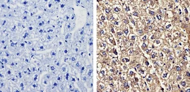 Anti-Recoverin antibody [6a55 cd6] used in IHC (Paraffin sections) (IHC-P). GTX79211