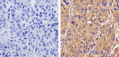 Anti-Recoverin antibody [6a55 cd6] used in IHC (Paraffin sections) (IHC-P). GTX79211