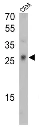 Anti-TCR V gamma 9 antibody [7A5] used in Western Blot (WB). GTX79233