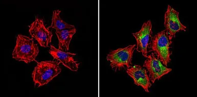 Anti-IGF2R antibody used in Immunocytochemistry/ Immunofluorescence (ICC/IF). GTX79239