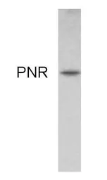 Anti-NR2E3 antibody used in Western Blot (WB). GTX79268