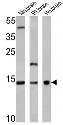 Anti-VAMP3 antibody used in Western Blot (WB). GTX79273