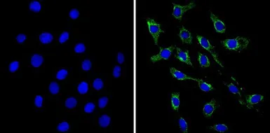 Anti-VAMP3 antibody used in Immunocytochemistry/ Immunofluorescence (ICC/IF). GTX79273