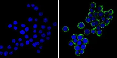 Anti-VAMP3 antibody used in Immunocytochemistry/ Immunofluorescence (ICC/IF). GTX79273