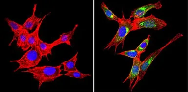 Anti-VAMP3 antibody used in Immunocytochemistry/ Immunofluorescence (ICC/IF). GTX79273