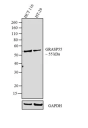 Anti-GRASP55 antibody used in Western Blot (WB). GTX79324