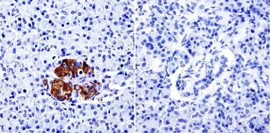 Anti-TIMP2 antibody [F27 P3 A4] used in IHC (Paraffin sections) (IHC-P). GTX79355