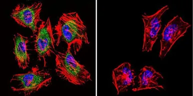 Anti-TIMP2 antibody [F27 P3 A4] used in Immunocytochemistry/ Immunofluorescence (ICC/IF). GTX79355