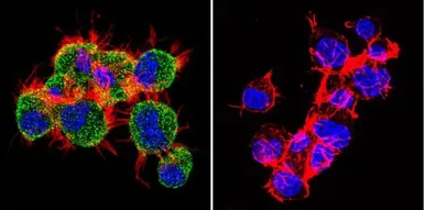 Anti-TIMP2 antibody [F27 P3 A4] used in Immunocytochemistry/ Immunofluorescence (ICC/IF). GTX79355