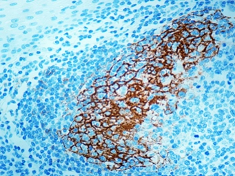 Anti-CD23 antibody [SP23] (ready-to-use) used in IHC (Paraffin sections) (IHC-P). GTX79430