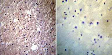 Anti-HCN3 antibody [TLL6C5] used in IHC (Paraffin sections) (IHC-P). GTX79455