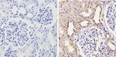 Anti-CYP3A7 antibody [F19 P2 H2] used in IHC (Paraffin sections) (IHC-P). GTX79463