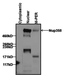 Anti-RANBP2 antibody [2E1] used in Western Blot (WB). GTX79468