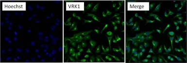 Anti-VRK1 antibody [1F6] used in Immunocytochemistry/ Immunofluorescence (ICC/IF). GTX79470