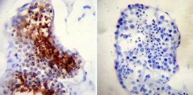 Anti-TPX2 antibody [18D5-1] used in IHC (Paraffin sections) (IHC-P). GTX79474