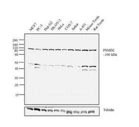 Anti-PSMD2 antibody used in Western Blot (WB). GTX79499