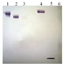 Anti-Plasminogen antibody [2F6-C6] used in Western Blot (WB). GTX79691