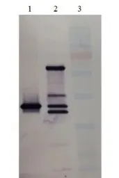 Anti-PAI-1 antibody used in Western Blot (WB). GTX79739