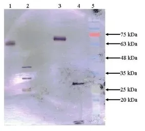 Anti-Factor IX antibody [13F42-F6] used in Western Blot (WB). GTX79803