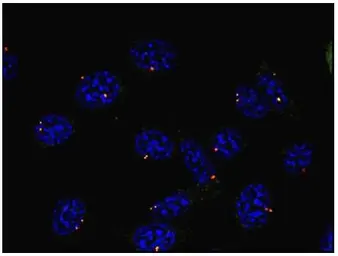 Anti-gamma Tubulin antibody [TU-30] used in Immunocytochemistry/ Immunofluorescence (ICC/IF). GTX79861