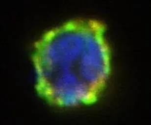 Anti-ENPP3 antibody [NP4D6] used in Immunocytochemistry/ Immunofluorescence (ICC/IF). GTX79907