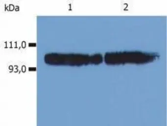Anti-CD18 antibody [MEM-48] (PE) used in Western Blot (WB). GTX79945