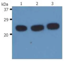 Anti-H-Ras antibody [H-RAS-03] used in Western Blot (WB). GTX80140