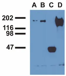 Anti-EGFR (phospho Tyr1173) antibody [EM-13] used in Immunoprecipitation (IP). GTX80161
