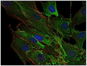 Anti-AHNAK antibody [EM-09] used in Immunocytochemistry/ Immunofluorescence (ICC/IF). GTX80164