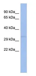 Anti-hCG beta antibody [WM16/71] used in Western Blot (WB). GTX80394