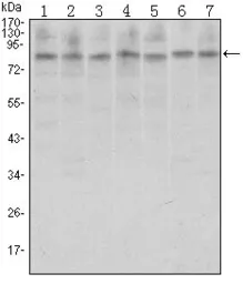 Anti-CTCF antibody [1D11] used in Western Blot (WB). GTX80397