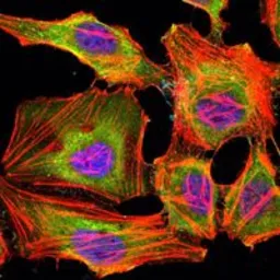 Anti-KDM3A antibody [2E1] used in Immunocytochemistry/ Immunofluorescence (ICC/IF). GTX80406
