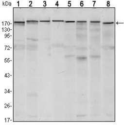 Anti-SETDB1 antibody [5H6A12] used in Western Blot (WB). GTX80408