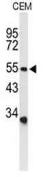 Anti-ASIC1 antibody, C-term used in Western Blot (WB). GTX80451