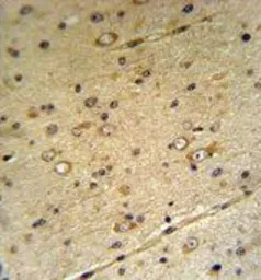 Anti-ZIP3 antibody, Internal used in IHC (Paraffin sections) (IHC-P). GTX80495