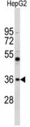 Anti-ELOVL2 antibody, N-term used in Western Blot (WB). GTX80506