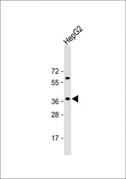 Anti-E2F5 antibody, N-term used in Western Blot (WB). GTX80623