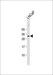 Anti-Nkx3.1 antibody, Internal used in Western Blot (WB). GTX80628