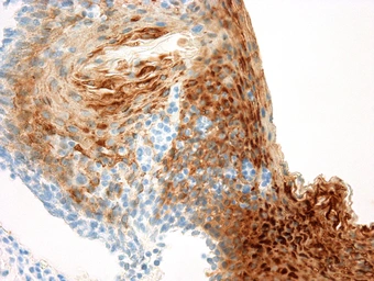 Anti-Cytokeratin 13 antibody [KS-1A3] used in IHC (Paraffin sections) (IHC-P). GTX80652