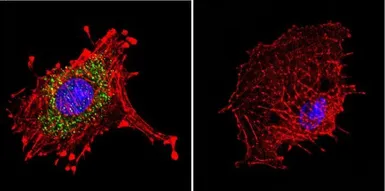 Anti-Dynein antibody [74.1] used in Immunocytochemistry/ Immunofluorescence (ICC/IF). GTX80684