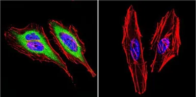 Anti-Dynein antibody [74.1] used in Immunocytochemistry/ Immunofluorescence (ICC/IF). GTX80684