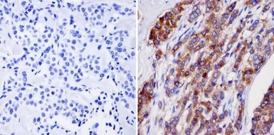 Anti-NMDAR2B antibody [NR2B] used in IHC (Paraffin sections) (IHC-P). GTX80691