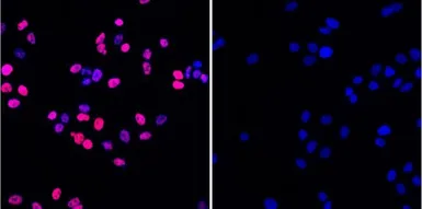Anti-Histone H2A.XS139ph (phospho Ser139) antibody [3F2] used in Immunocytochemistry/ Immunofluorescence (ICC/IF). GTX80694