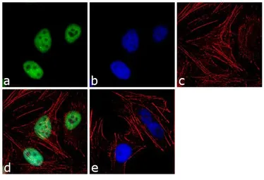 Anti-KAP1 antibody [20C1] used in Immunocytochemistry/ Immunofluorescence (ICC/IF). GTX80695