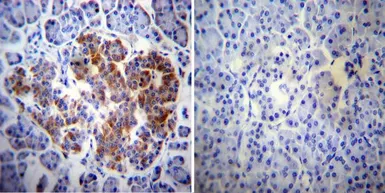 Anti-Her4 / ErbB4 antibody [HFR1] used in IHC (Paraffin sections) (IHC-P). GTX80811