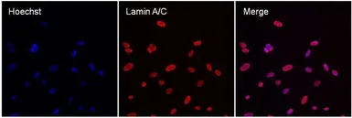 Anti-Lamin A + C antibody [mab636] used in Immunocytochemistry/ Immunofluorescence (ICC/IF). GTX80813