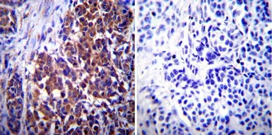 Anti-Vimentin antibody [J144] used in IHC (Paraffin sections) (IHC-P). GTX80814