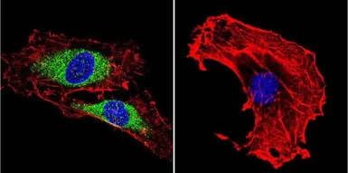 Anti-Vimentin antibody [J144] used in Immunocytochemistry/ Immunofluorescence (ICC/IF). GTX80814